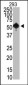 SET07 Antibody