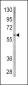 BMPR1A Antibody (C-term)