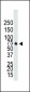 BMPR1B Antibody (C-term)