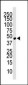 Chemokine Receptor D6 (CCBP2) Antibody (C-term)