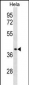 Chemokine Receptor D6 (CCBP2) Antibody (C-term)