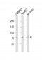 CD73 (NT5E) Antibody (C-term)