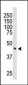 DOK2 Antibody (C-term)