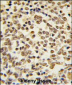 MAPK7 Antibody (C-term)