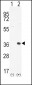 PIM2 Antibody (C-term)