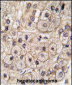 AC133 (CD133) Antibody (C-term)