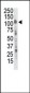 Insulin Receptor R Antibody (C-term)
