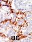 PAK3 Antibody (Center K218)