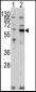 PAK3 Antibody (Center K218)