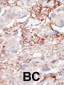 MST2 Antibody (C-term)