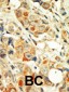 PKC alpha Antibody (C-term)