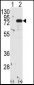 PKC beta1/2 Antibody (Center)