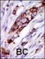 GRK5 Antibody (C-term)