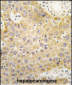 GRK5 Antibody (C-term)