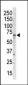 GRK5 Antibody (C-term)