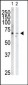 GRK6 Antibody (C-term)