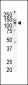 RET Antibody (C-term T1078)