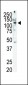 RET Antibody (C-term T1078)