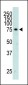 AD_K2 Antibody (C-term)