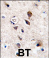 PKC gamma Antibody (C-term)
