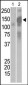 SARS Coronavirus Spike Glycoprotein Antibody