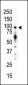 PKC mu Antibody (N-term)