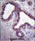 MAPK8 Antibody (C-term)