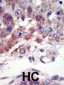 JNK2 (MAPK9) Antibody (C-term)