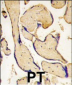 EphA3 Antibody (C-term)