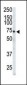 EphA3 Antibody (C-term)