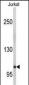 EphA5 Antibody (C-term)