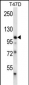 EphB1 Antibody (C-term)