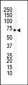 EphB6 Antibody (C-term H990)