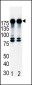 AP7629a-ERBB2-AntibodyN-term