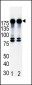 ERBB2 Antibody(N-term)