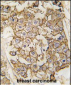 ERBB2 Antibody(N-term)