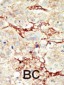 FGFR3 Antibody (C-term)