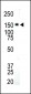 IGF1 Receptor (IGF1R) Antibody (C-term)