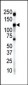 Insulin Receptor R Antibody (N-term)