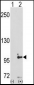 DDR1 Antibody (C-term)