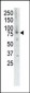 MUSK Antibody (C-term)