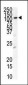 PDGFRB Antibody (N-term)