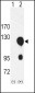 ROR2 Antibody (N-term)