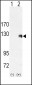 ROR2 Antibody (C-term)