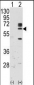 RYK Antibody