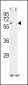 RYK Antibody (C-term)