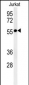 STK33 Antibody (C-term)