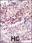 TEK (TIE2) Antibody (C-term)