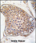 TEK (TIE2) Antibody (C-term)