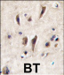 TIE Antibody (N-term)